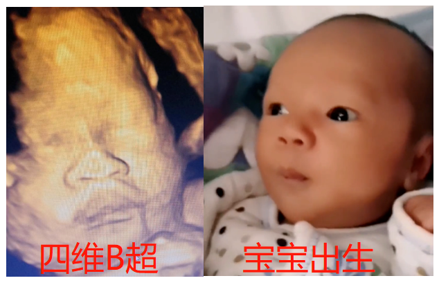 還沒出生就被親媽嫌棄？寶寶：你看我還有機會嗎