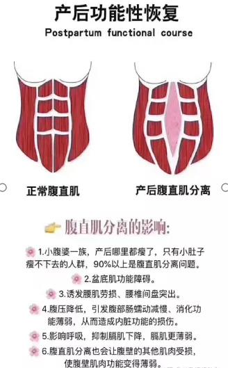 產(chǎn)后修復(fù)六大誤區(qū)！今天一并告訴你解決方法