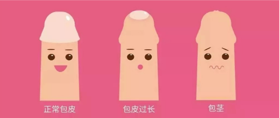 孩子身上這點“皮”可能壞事？抓緊處理！