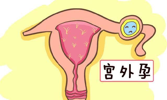 哪些“異常信號”會提示有宮外孕的風險？